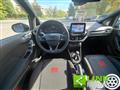 FORD FIESTA 1.0 Ecoboost Hybrid 125 CV 5 porte ST-Line