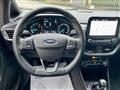 FORD FIESTA 1.0 Ecoboost 100 CV 3 porte ST-Line